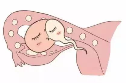 供卵代生医院代生包成功